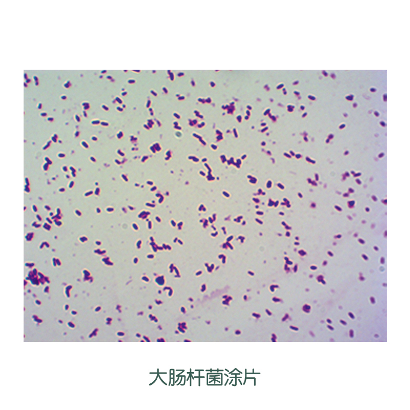 大肠杆菌涂片