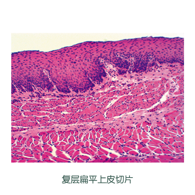 复层扁平上皮切片